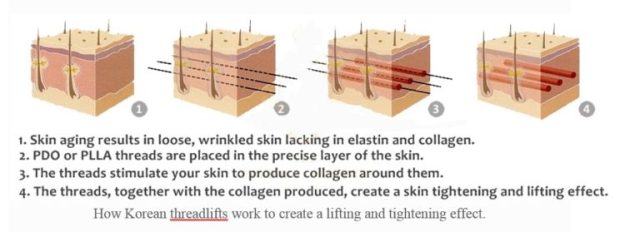 Ultra-V-Lift-4-768x279